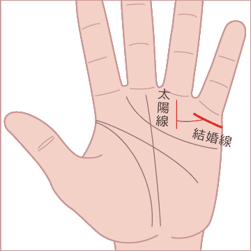 結婚線の支線の末端が太陽線にくっついているの画像
