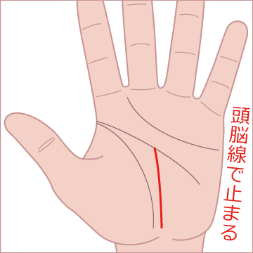 運命線が頭脳線で止まっているの画像